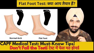 quotFlat Foot Medical Test for CAPF  Causes of Flat Foot Rejection amp How to Prevent Disqualificationquot [upl. by Nnylassej]