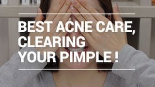 The Best ACNE Care Tips for Clearing Pimple with Eunices naked face XD  Wishtrend [upl. by Thaddaus1]