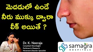 Understanding Brain Fluid Leak CSF Rhinorrhea Causes Symptoms amp Treatment  Dr Neeraja [upl. by Almeida]