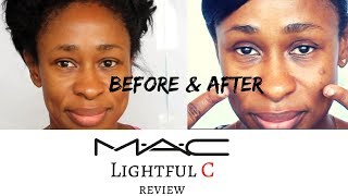 Before amp After M A C Lightful C [upl. by Anerres953]