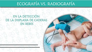 Ecografía vs Radiografía para la detección de la displasia de Caderas en Bebes [upl. by Anaigroeg]