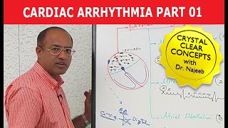 Cardiac Arrhythmia  Part 13 [upl. by Evadne]