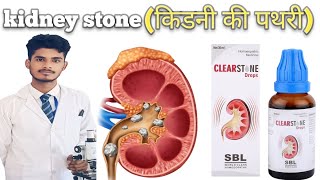 Clear stone drops SBL Medicine 💊 ll viral video kidney stones [upl. by Dnallor]