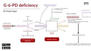 Glucose 6 Phosphate Dehydrogenase Deficiency by Dr Pawan nagar [upl. by Lahcar441]