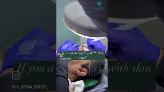 Skin Tag Removal ghdermacenterhospital2196 [upl. by Oglesby]