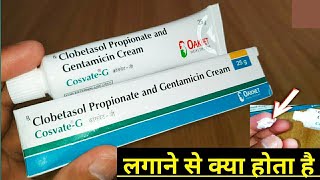 Cosvate G Cream Uses In Hindi  Clobetasol Propionate And Gentamicin Cream  कॉसवेट जी क्रीम [upl. by Granoff]