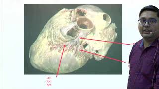 IDoR2018 Cardiac Basics of Coronary Anatomy [upl. by Ahsenyl]