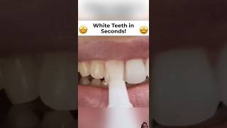 Viral Teeth Whitening Pen teethwhitener shorts [upl. by Acemat551]