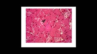 Pancreatic Acinar Cell Lab [upl. by Otilrac]