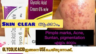 How to use glycolic Acid creamGlyco 6ww Review in malayalam [upl. by Adym]