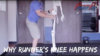 E32 How Runners Knee Happens [upl. by Merkle]