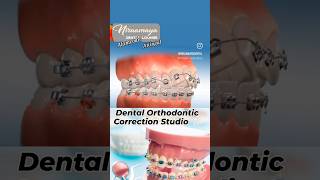 Dental Orthodontic Correction Studio fastest Smile Correction centre Alamcode Attingal Varkala [upl. by Howlond]