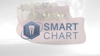 SmartChart™  Overview and Detailed Demonstration [upl. by Tillman]