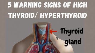 Warning signs of hyperthyroid symptoms of high thyroid thyroid ke lakshan thyroid [upl. by Adnohsak]