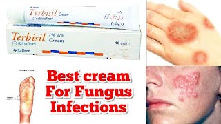 Terbisil Cream uses in urdu  Best Cream for fungus Infections [upl. by Windy]