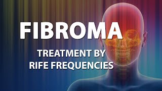 Fibroma  RIFE Frequencies Treatment  Energy amp Quantum Medicine with Bioresonance [upl. by Hairem]