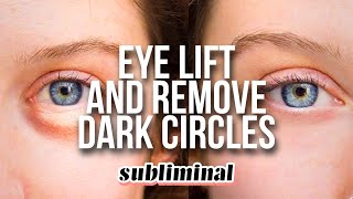 GET RID OF DARK CIRCLES  EYE BAGS EYE LIFT EYEBROW LIFT SUBLIMINAL [upl. by Airoled]