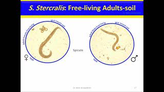 Strongyloides stercoralis Nematodes [upl. by Bushey166]