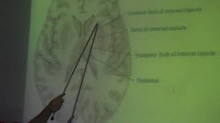 Neuroanatomy 89  Lentiform amp amygdaloid nuclei   by Dr Wahdan [upl. by Matthei989]