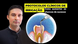 Irrigação em Endodontia Principais protocolos clínicos [upl. by Sufur]