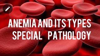 Aplastic anemia  myelophthisic anemia part12 hematopoietic and lymphoid system [upl. by Chaille]