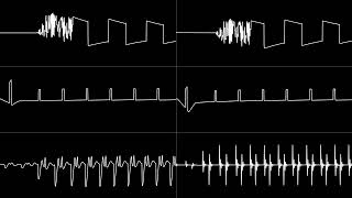 Laxity amp Glenn Rune Gallefoss  “The Other Day” Stereo Mix C64 6581 amp 8580 SID Oscilloscope View [upl. by Norvun]