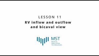 MST Masterclass  Lesson 11  RV inflow and outflow and bicaval view [upl. by Dlaregztif]