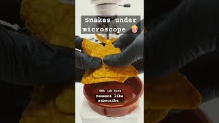 Snacks🍿 under microscope 🔬 Shocking 😳 results 💯 science lab laboratory scienceclass foryou [upl. by Gnurt608]