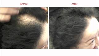 Hair Building Fiber For Hair Loss In Women [upl. by Edak]