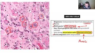 NEUROPATHOLOGY BOARD REVIEW 2 [upl. by Rexana]