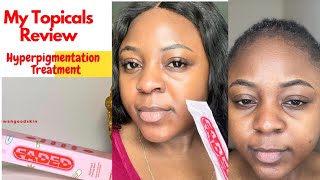 WATCH THIS REVIEW for Hyperpigmentation Treatment  FADE SERUM BY MYTOPICALS [upl. by Ezzo]