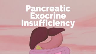 Pancreatic Exocrine Insufficiency  Gastrointestinal Society [upl. by Culhert]