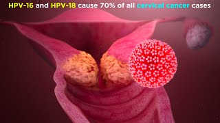 Human Papillomavirus HPV [upl. by Aniger]