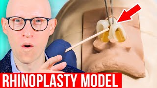 RHINOPLASTY Explained by Plastic Surgeon [upl. by Aillimac]