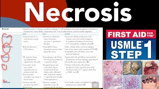 Necrosis Coaglative Liquefactive Caseous Fat Fibrinoid necrosis in HindiUrdu by first aid [upl. by Ailelc]