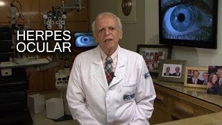 Herpes Ocular [upl. by Akemet]