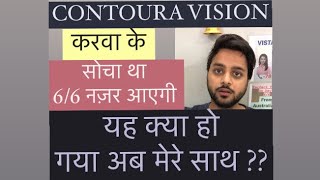 Best LASIK eye Surgery in Delhi  Best LASIK Surgeon In Delhi  CONTOURA VisionLASIK Dr Aman Malik [upl. by Aeresed]