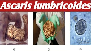 How To diagnose  Ascaris Lumbricoides [upl. by Sundberg649]