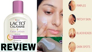 Lacto Calamine face Lotion Review How To Use lacto Calamine Lotion lactocalaminelotion [upl. by Anyl]