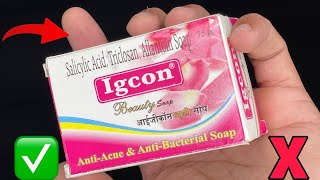 Igcon Cream Side Effects kaise thik kare  Fairness in 3 night [upl. by Laucsap755]