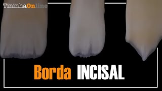 Borda Incisal [upl. by Luis]