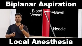 Biplanar Aspiration during Nerve Block [upl. by Atinreb829]