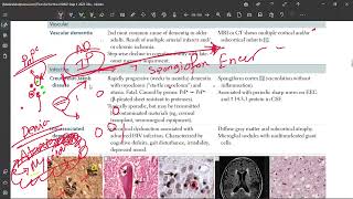 49 Creutzfeldt Jakob Diseases [upl. by Spaulding]