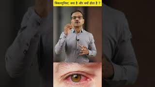 quotTop 8 Chikungunya Symptoms You Shouldnt Ignore  Dr Prabhakar Jaybhayequot chikungunya care [upl. by Terrell512]