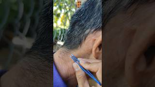 Part 23 Plucking Gray neck hair [upl. by Larina]