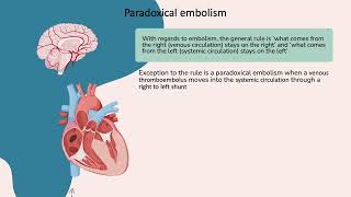 Paradoxical embolism [upl. by Amery]