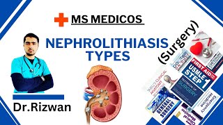 NephrolithiasisSurgeryMS MedicosDr RizwanUrdu Hindi Easy Explanations [upl. by Chip]