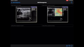 Tutorial 9 How to add a sonogram or other images to radiologist final report [upl. by Toille148]