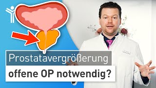 Prostatavergrößerung Prostata zu groß für minimalinvasive OP [upl. by Eniamahs]