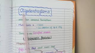 CNS Tumors  Robbins Pathology [upl. by Gothurd365]